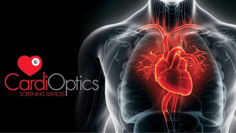 CardiOptics Screening Services