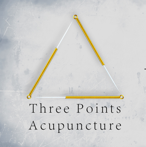 Three Points Acupuncture